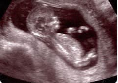Fertility Scan